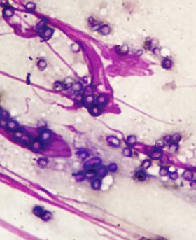 Microscopic image showing purple dyed circular particles and streaks on a light background.