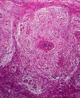 Microscopic image of a purple cell.