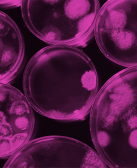 A collection of petri dishes growing micro-organisms