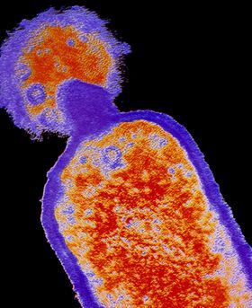 Coloured electron microscope image of a bacteriophage virus.