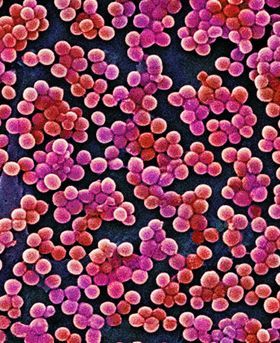 Microscopic image showing multiple red/pink particles scattered on a dark background resembling cellular structure.