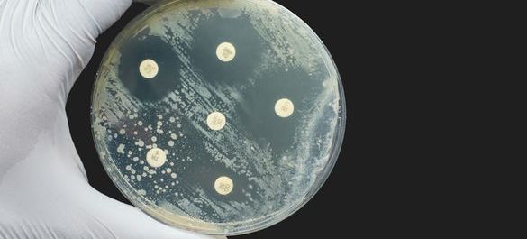 Petri-dish testing for Antimicrobial Susceptibility testing. 