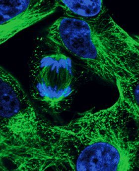 Microscopic image showing multiple cells on a dark background.