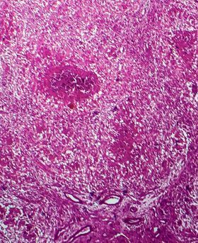 Close up microscopic image of a pink cell.