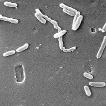 Pseudomonas aeruginosa under a SEM