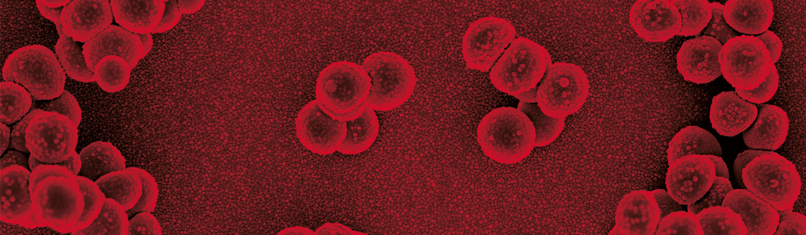 Journal of Medical Microbiology